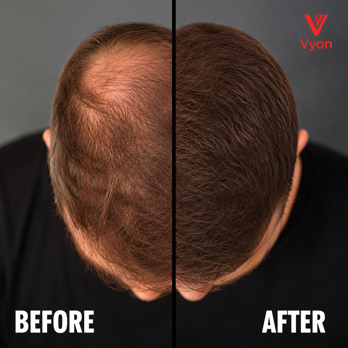 Vyon Premium Hair Powder
