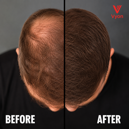 Vyon Premium Hair Powder
