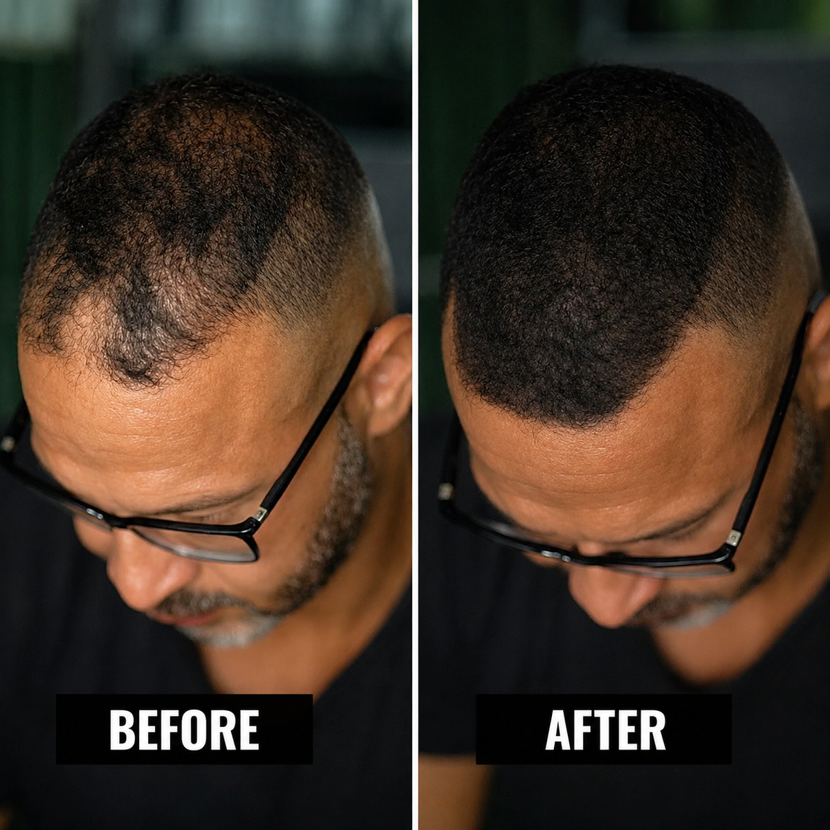 Vyon Premium Hair Powder